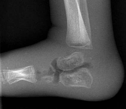 Better baby x-rays
