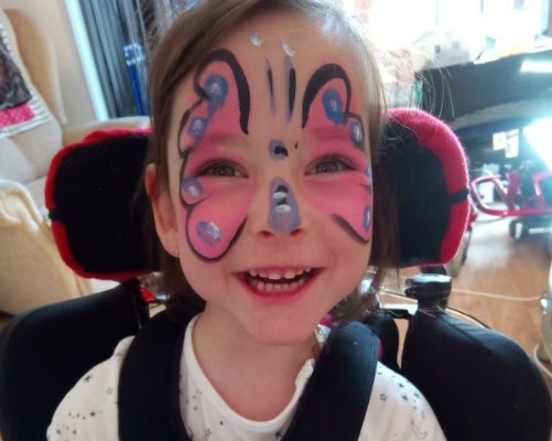 Anastasia after treatment, smiling and wearing facepaint.