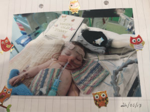 A picture of a baby having treatment at Evelina London from a PICU diary.