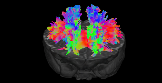 A child's brain scan