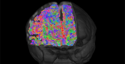 A detailed brainscan of a child using very bright colours