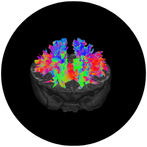 Connections in the brain