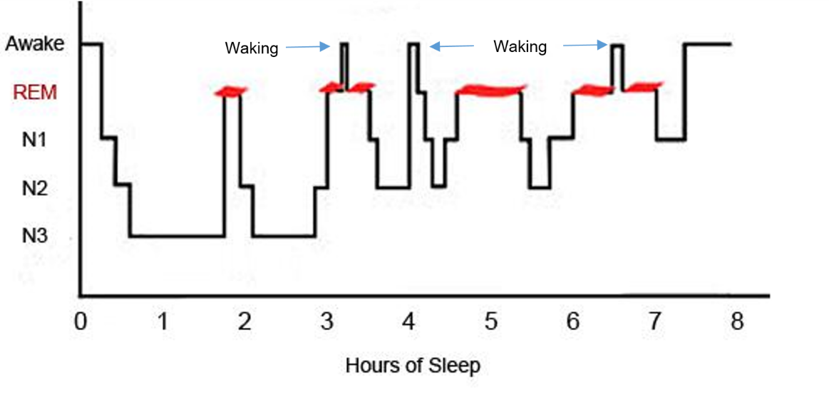 A hypnographic of sleep