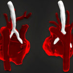 3D image of a fetal heart